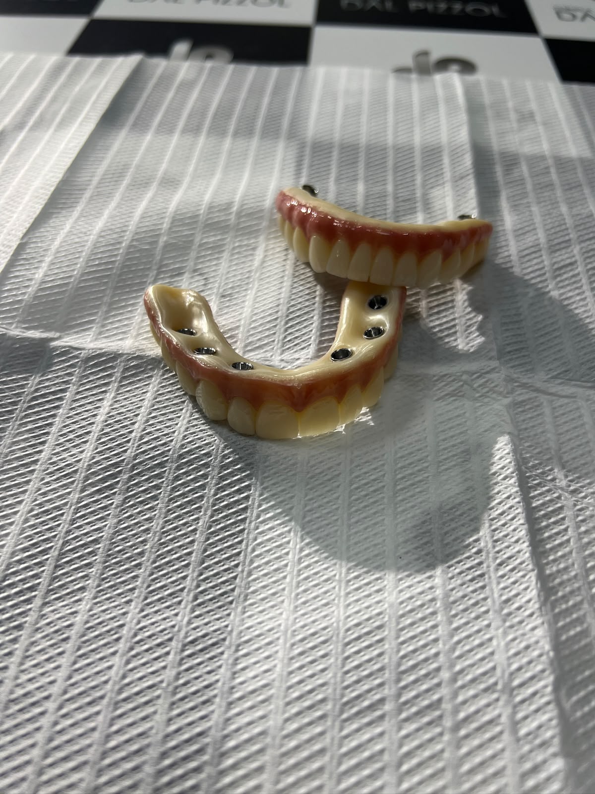 Prótese protocolo com conexões para implantes