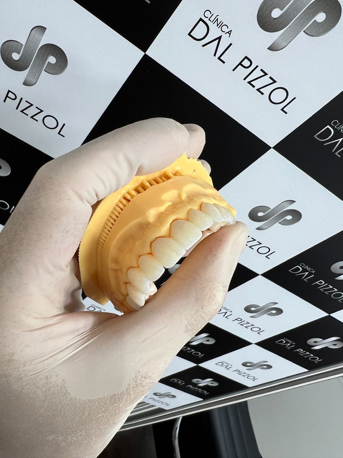 Modelo protético produzido no fluxo digital da clínica
