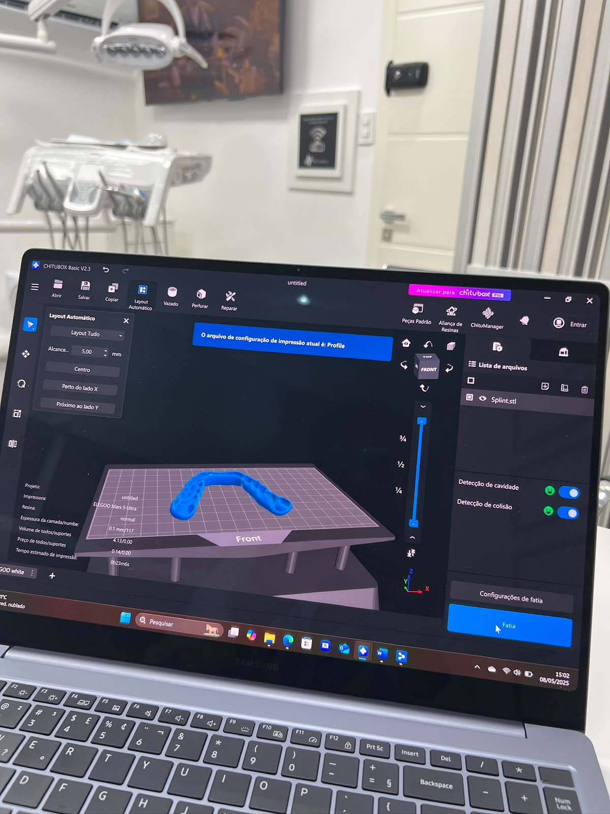 Modelo odontológico preparado em software de impressão 3D