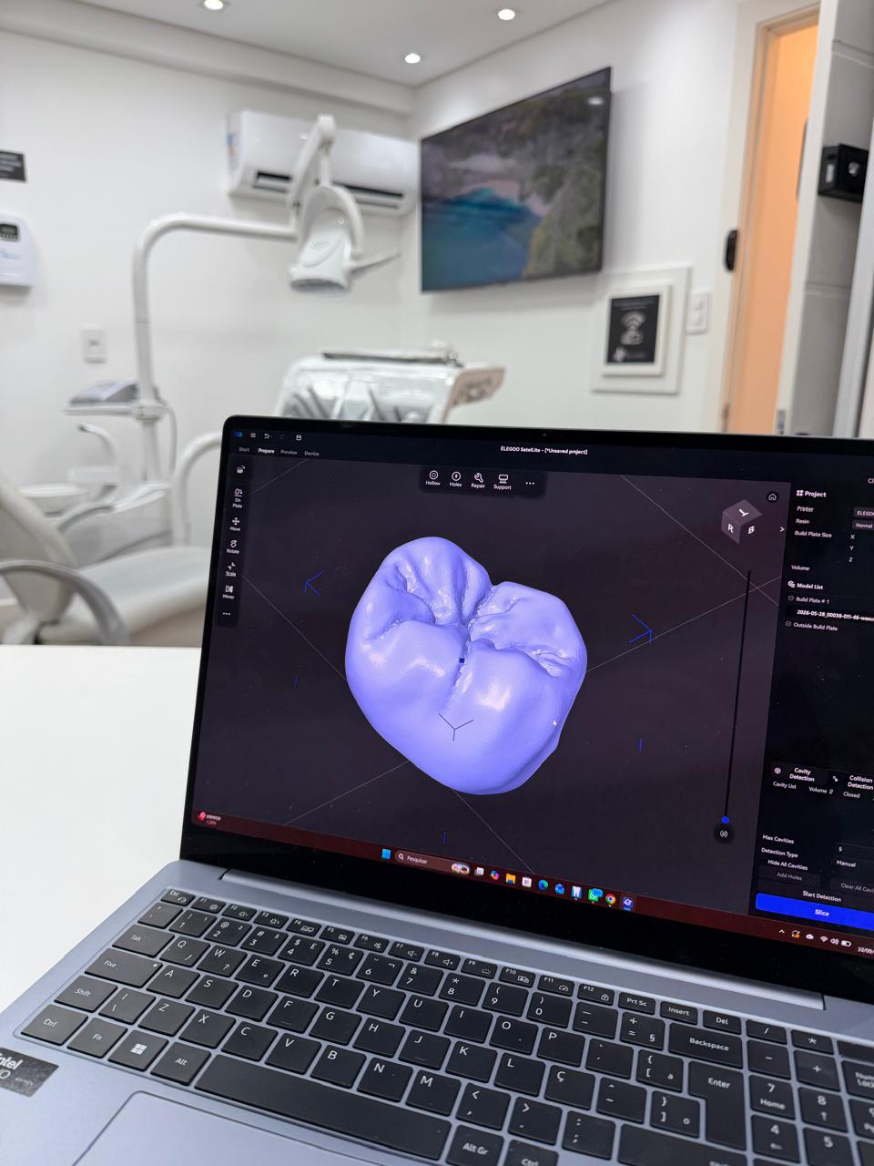 Design CAD de restauração odontológica no consultório