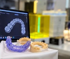 Monitor com planejamento digital de alinhadores odontológicos
