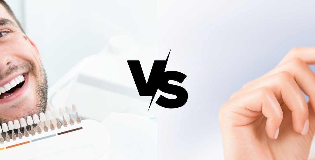 Lente de contato dental versus clareamento dental: qual é a melhor opção para você?
