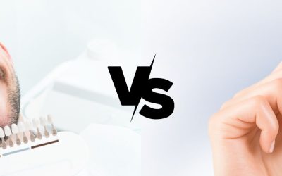 Lente de contato dental versus clareamento dental: qual é a melhor opção para você?